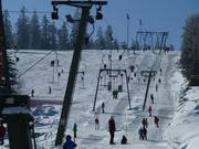 Skilift Kaltenbronn II - Schlepplift mit T-Bügel/Anker