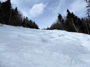 Die Buckelpisten fordern auch den Könner